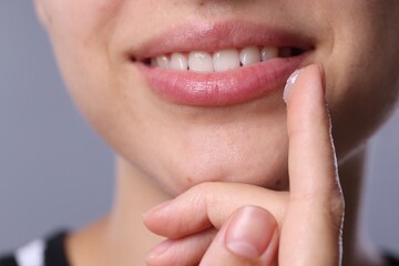 Young woman with lip balm on light grey background, closeup
