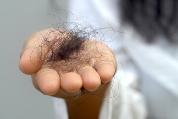 Hair loss in the center of the head or along the forehead