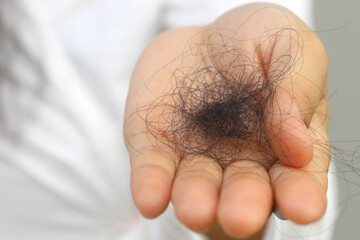 Hair loss in the center of the head or along the forehead
