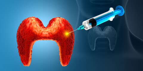 Treatment of thyroid disease concept. Steroid injection. 3d illustration