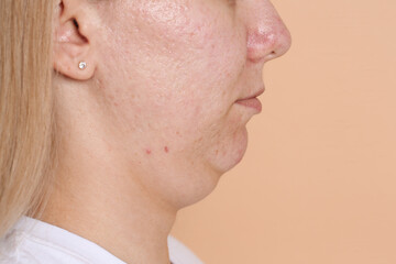Fototapeta premium Woman with double chin on beige background, closeup. Space for text
