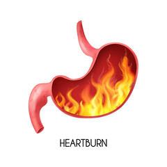 1906.i305.004.S.m005.c10.realistic human internal organ stomach pyrosis fire disorder gastric acid reflux abdominal bloated ball nausea