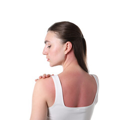 Woman with sunburned skin on white background