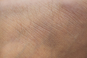 Macroscopic human skin texture,Macro texture of dry human skin, dehydrated epidermis closeup view,...