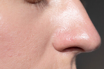 Extreme close-up of human nose skin showing visible pores and natural texture. High-resolution...
