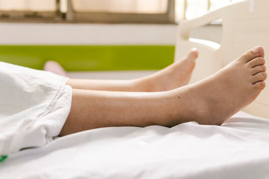A person lies in a hospital bed, showing only their legs and feet on white sheets. The environment suggests recovery or medical rest in a clinical setting