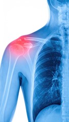 X-ray image of shoulder joint with highlighted inflammation in red