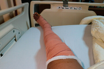 a man's leg wrapped in a bandage after surgery