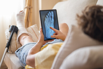 Patient with a broken foot in a cast pointing at a foot x-ray on a tablet while resting on a sofa...