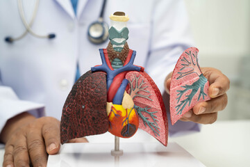Pneumonia, lung cancer, Asian doctor holding human anatomy model for study diagnosis and treatment...
