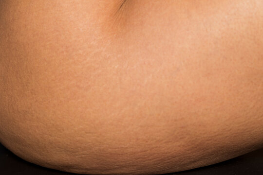 skin details