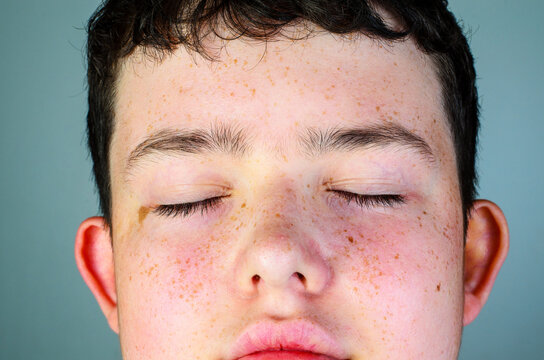Close up of teenage boy face with closed eyes and freckles