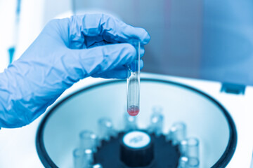 Scientist hand wear blue gloves holding glass blood test tube and reagent into the centrifuge for...