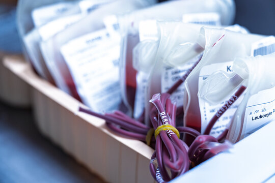 Blood bag for safe life emergency patient.Leukocyte poor pack red cell in transfusion bag on a tray inside blood bank.Rare blood group prepares for donation or therapy of anemia patient in hospital.