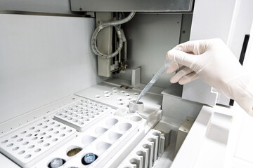 Scientist hand holding and using droplet drop reagent for blood chemical analysis in automatic...