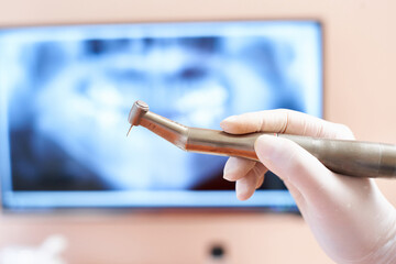 歯科ドリルと歯のレントゲン