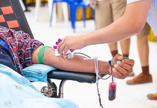 Healthcare professional assisting a donor during blood donation. Symbol of compassion, medical care, and volunteer support in a clinical setting