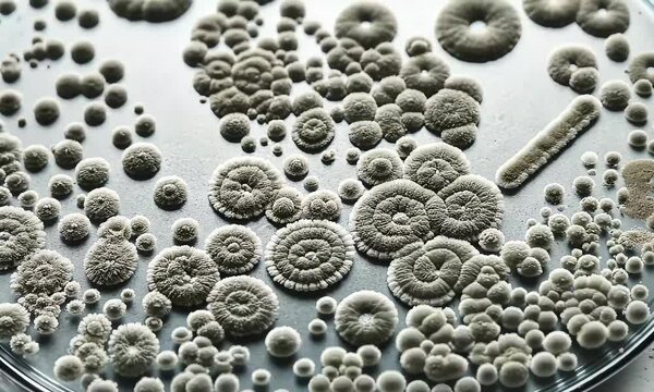 Macro Shot of Gray Bacteria Colonies Growing in a Petri Dish Scientific Laboratory Setting