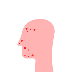 red head with acne like problematic skin icon