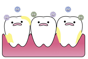 汚れとばい菌で歯周病になってしまった歯肉と歯のコミカルなイラスト