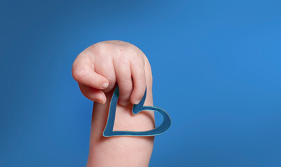Concept close up infant hand with typical overlapping fingers of Trisomy 18 syndrome holding open...