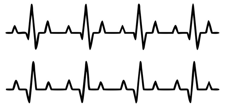 Heartbeat line set. EKG. Vector