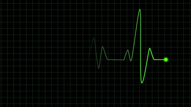 High resolution EKG pulse line animation. Animated green heartbeat graph medical technology 4K. Medical technology heartbeat line animation. Science data rhythm digital monitor screen loop.