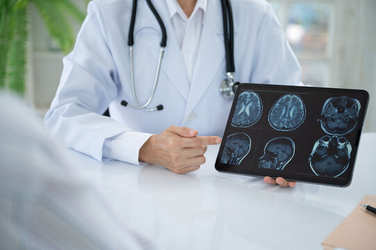 Neurologist Doctor treatment planning for diseases nervous system and brain with patient about cerebrovascular disease, migraine, Parkinson's disease, dementia and stroke at Neurology Center.