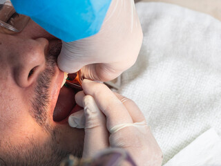 Close-up of a dentist performing interdental cleaning using dental floss as part of a full oral...