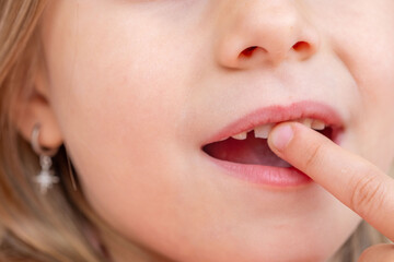 Little girl wiggling loose baby tooth with finger, Child focused on wobbly tooth, exploring changes...