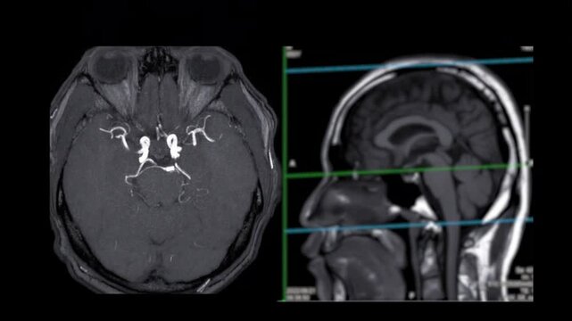 Detailed MRI/CT Scan of Human Brain Structures