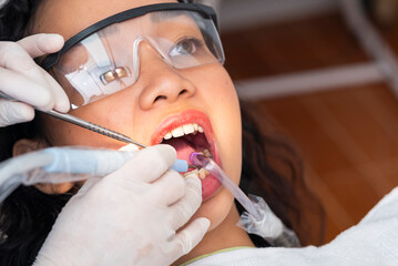 Dental professional performs ultrasonic scaling and suction on a young woman during a routine oral...