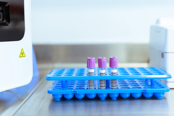Vacutainer Tubes with EDTA Additive in Laboratory Rack for Blood Collection and Analysis