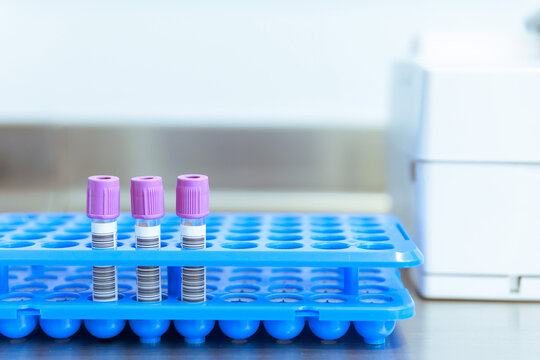 Vacutainer Tubes with EDTA Additive in Laboratory Rack for Blood Collection and Analysis