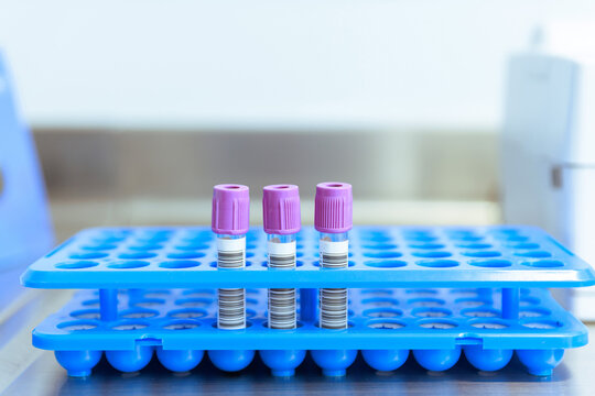 Vacutainer Tubes with EDTA Additive in Laboratory Rack for Blood Collection and Analysis