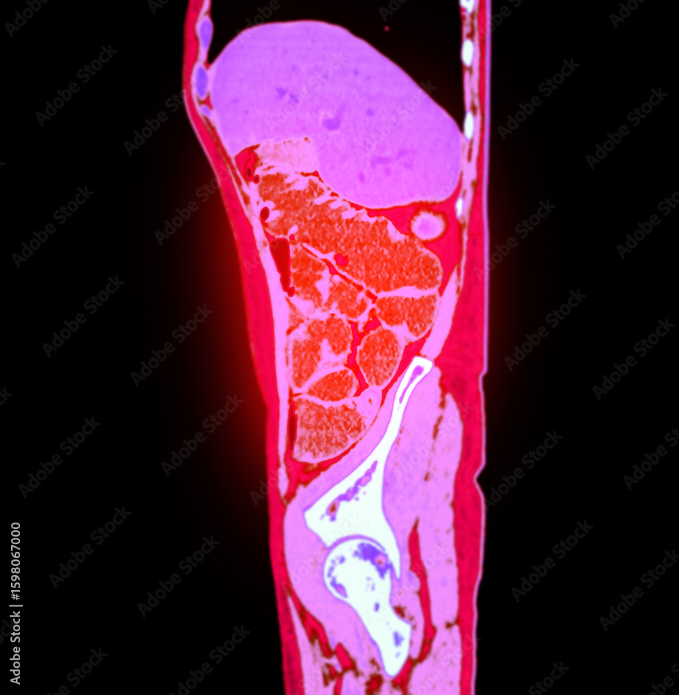 Aufkleber high-resolution abdominal ct image highlighting vascular and organ anatomy with intense color mappin