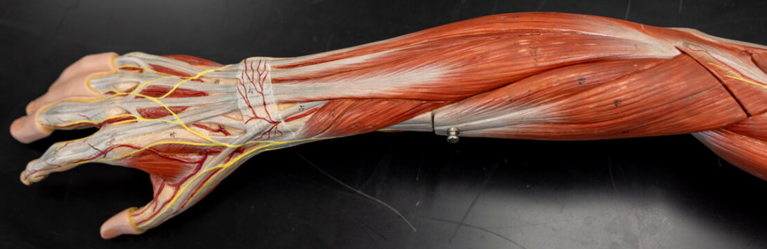 Superficial Forearm Dissection Focused On Wrist Extensor Muscles