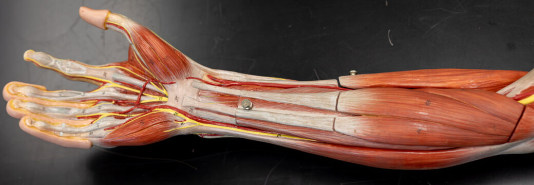 Anterior Forearm With Superficial Flexor Muscles Exposed