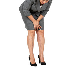 Varicose Veins on Legs of a Businesswoman Photo