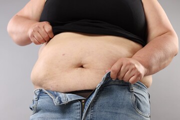 Woman with excessive belly fat on grey background, closeup. Overweight problem