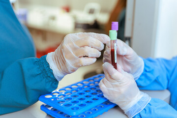 Healthcare Professionals Handling Blood Sample for Laboratory Analysis
