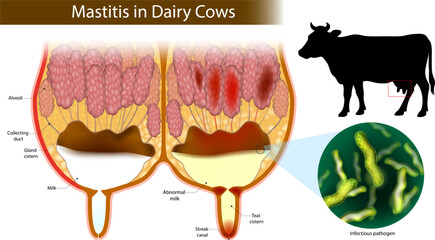 Detailed medical illustration of mastitis in dairy cows, showing a cross-section of a healthy and infected udder. Cow Mastitis with Pathogen and Abnormal Milk