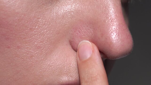 Macro view of nose pores with visible skin texture and finger touching area. Perfect for skincare, dermatology, esthetics, or cosmetic visuals. Realistic lighting and clarity.