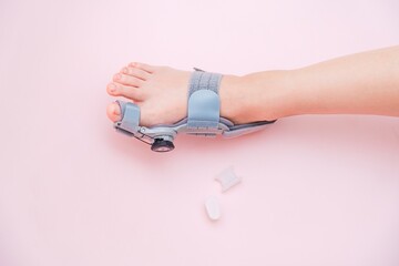 View on hallux valgus orthopedic medical thumb brace on female foot and silicone finger separator