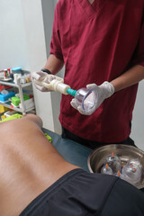 Male therapist preparing cupping therapy tools before treatment. Traditional healing setup for body relaxation, detox, and muscle recovery