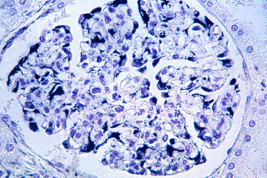 Renal glomerulus. Podocytes