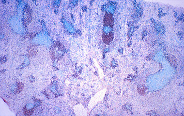 Human spleen. B lymphocytes