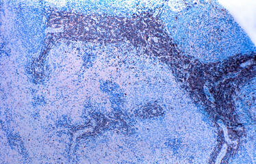 Human spleen. T lymphocytes