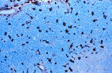 Human spleen. Macrophages