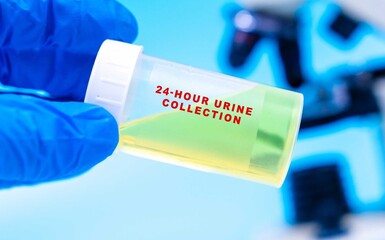 Measures substances excreted in urine over 24 hours for